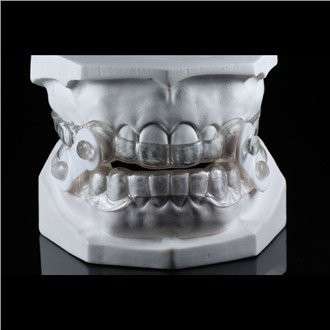 Horlamani nazorat qilish qurilmalari